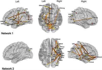 White Matter Network Disruption and Cognitive Dysfunction in Neuromyelitis Optica Spectrum Disorder